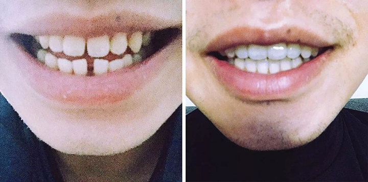 1512024300688221.jpg 1512024300688221.jpg